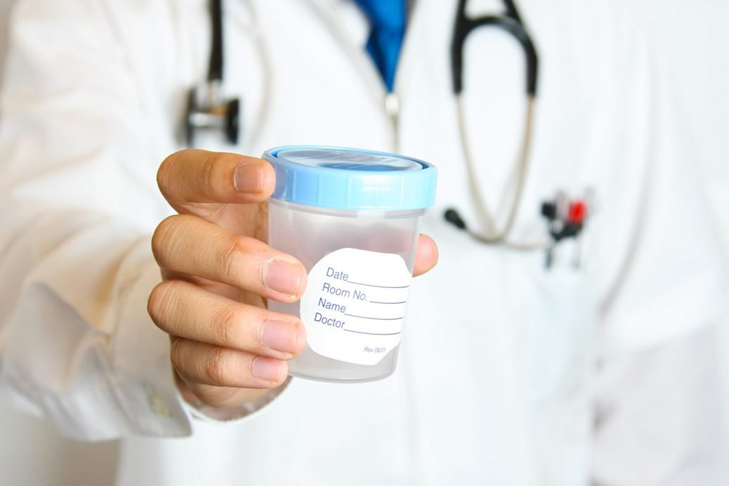 Urinocoltura Che Cos'è e Come si Esegue Benessere Urinario Urinocoltura Che Cos'è e Come si Esegue Benessere Urinario